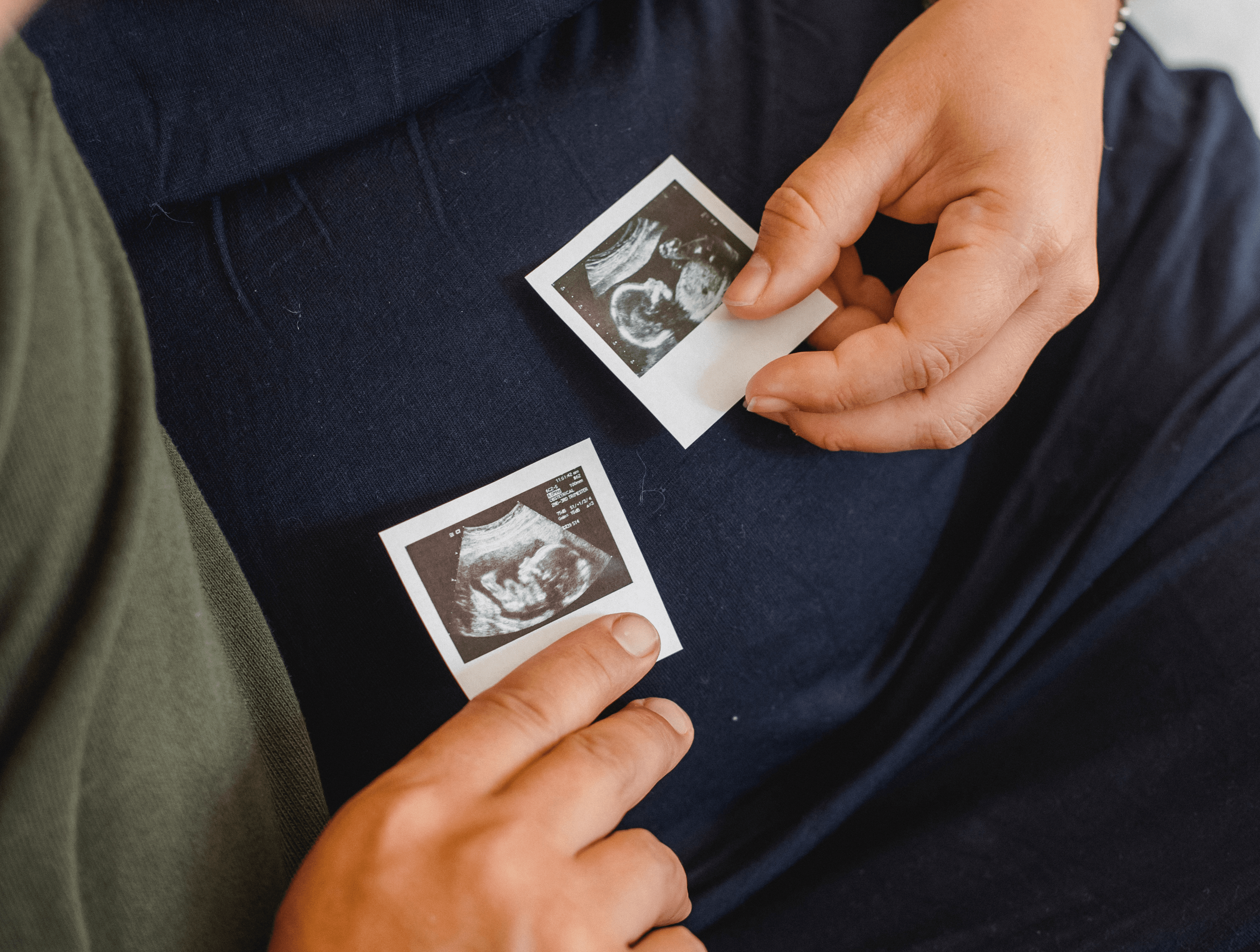 couple holding ultrasound photo against pregnant belly